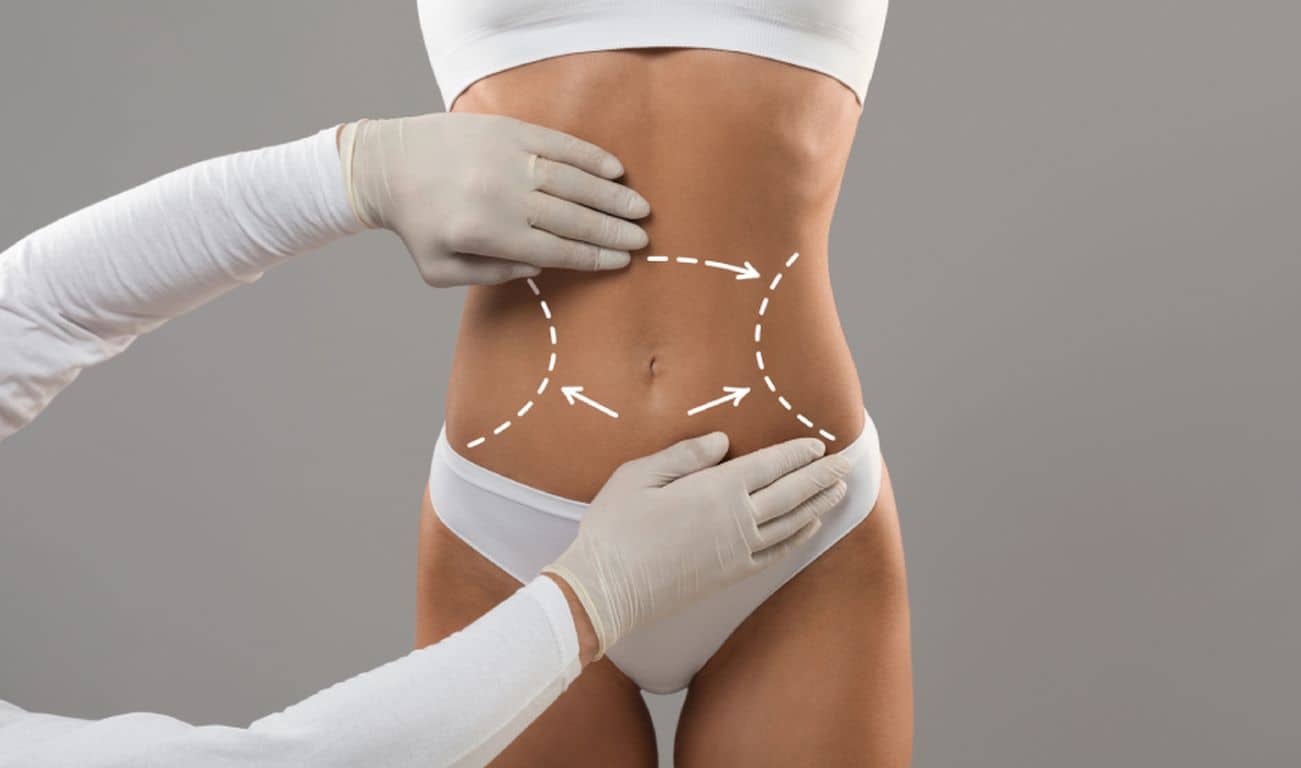 Body Sculpting